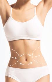 Beyond Perfection: The Miami Oasis for Tummy Tuck Excellence post thumbnail image