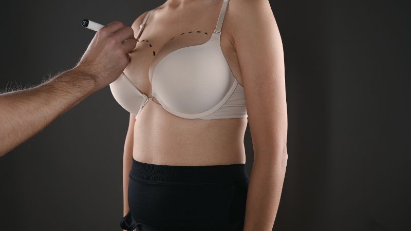 Miami’s Beauty Revolution: The Magic of Breast Augmentation post thumbnail image