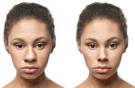 Cultural Symmetry: Ethnic Rhinoplasty in Los Angeles post thumbnail image